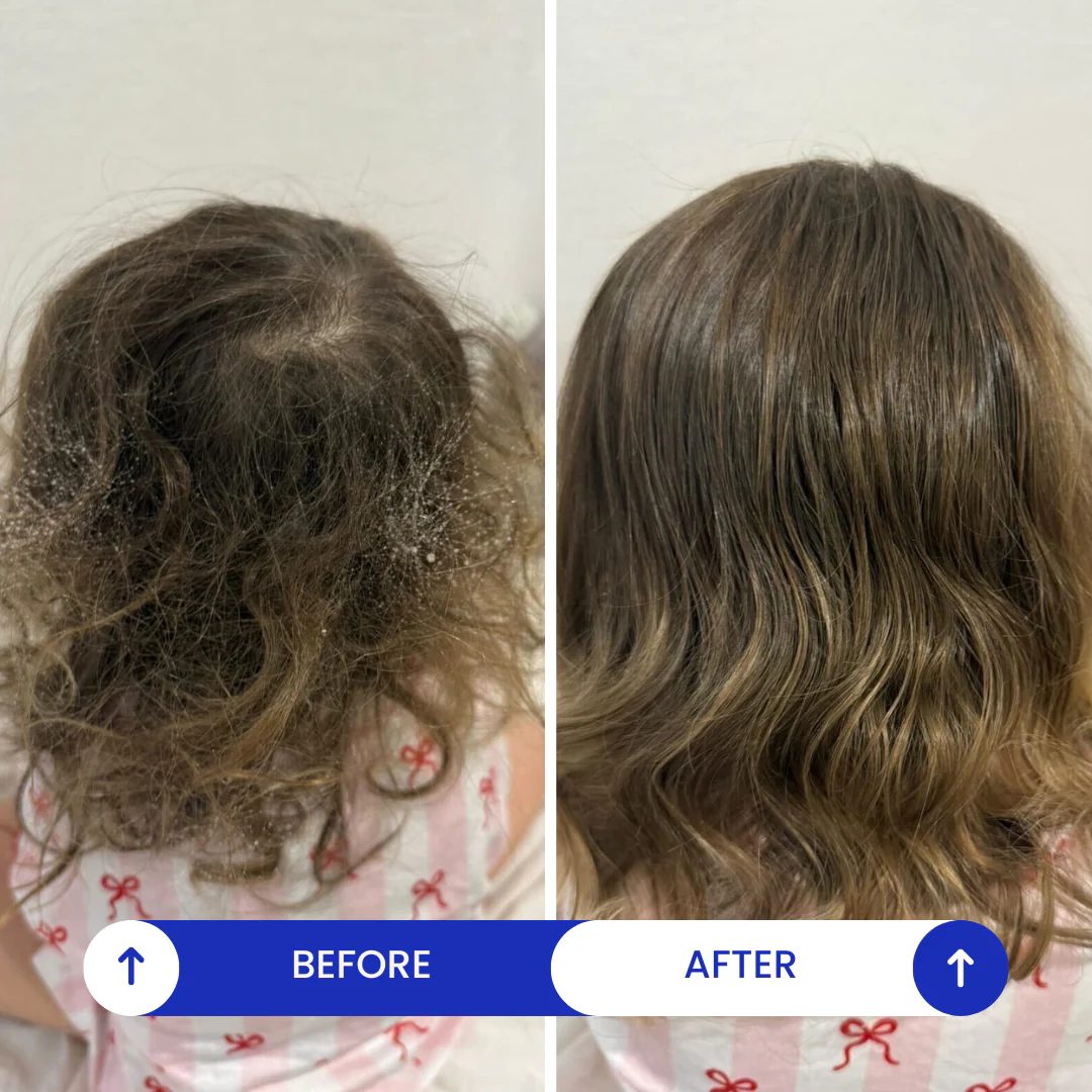 DETANGLING SPRAY